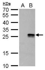 NME6 Antibody in Western Blot (WB)