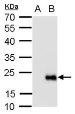 RGS19 Polyclonal Antibody