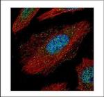 TAB1 Polyclonal Antibody
