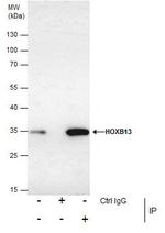 HOXB13 Antibody in Immunoprecipitation (IP)