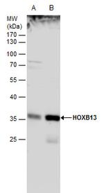 HOXB13 Polyclonal Antibody