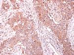 ARPC1A Polyclonal Antibody