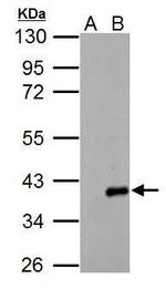 ARPC1A Antibody in Western Blot (WB)