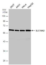 SLC19A2 Antibody in Western Blot (WB)