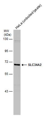 SLC34A2 Polyclonal Antibody