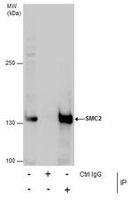 SMC2 Antibody in Immunoprecipitation (IP)