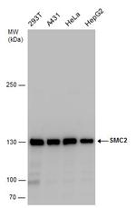 SMC2 Polyclonal Antibody