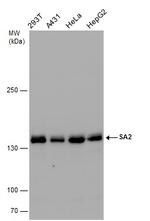 STAG2 Antibody in Western Blot (WB)