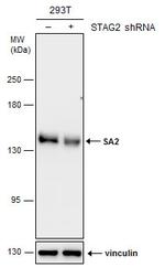 STAG2 Antibody in Western Blot (WB)