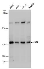 STAG2 Antibody in Western Blot (WB)