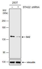 STAG2 Antibody in Western Blot (WB)