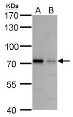 MMP24 Polyclonal Antibody