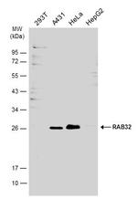 RAB32 Polyclonal Antibody