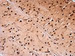 NUDT21 Polyclonal Antibody