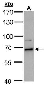 DDX52 Antibody in Western Blot (WB)