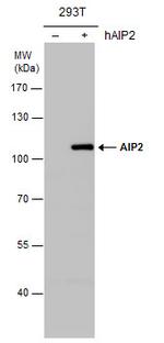 AIP2 Polyclonal Antibody