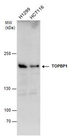 TOPBP1 Antibody in Western Blot (WB)