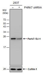 DJ-1 Antibody in Western Blot (WB)