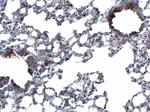 TWF2 Polyclonal Antibody