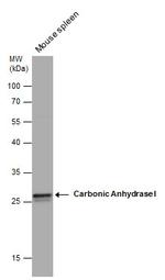 Carbonic Anhydrase I Polyclonal Antibody
