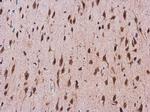 CDK5 Antibody in Immunohistochemistry (Paraffin) (IHC (P))