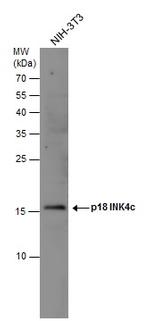CDKN2C Antibody in Western Blot (WB)
