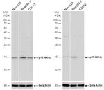 CDKN2C Antibody in Western Blot (WB)
