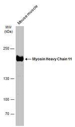 MYH11 Polyclonal Antibody