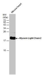 MYL2 Antibody in Western Blot (WB)