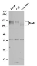NFATC3 Antibody in Western Blot (WB)