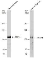 NFATC3 Polyclonal Antibody