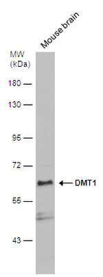 SLC11A2 Antibody in Western Blot (WB)