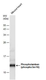 Phospho-Phospholamban (Ser16) Antibody in Western Blot (WB)