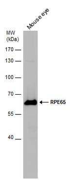 RPE65 Polyclonal Antibody