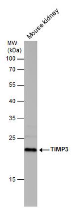 TIMP3 Antibody in Western Blot (WB)