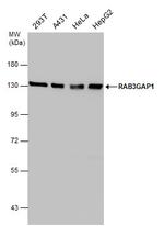 RAB3GAP1 Polyclonal Antibody