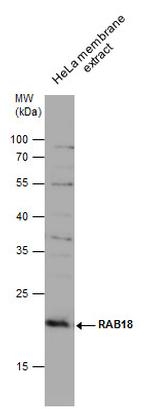 RAB18 Polyclonal Antibody