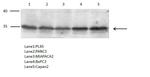 PTGR1 Polyclonal Antibody