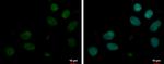 MYT1L Polyclonal Antibody