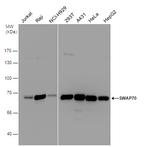 SWAP70 Antibody in Western Blot (WB)