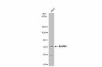 SARM Antibody in Western Blot (WB)