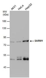 SARM Antibody in Western Blot (WB)