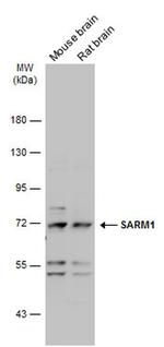SARM Antibody in Western Blot (WB)