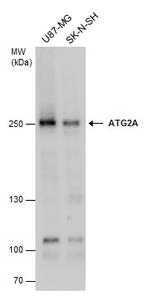 ATG2A Polyclonal Antibody