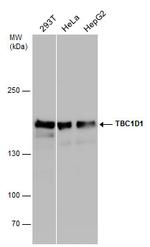 TBC1D1 Polyclonal Antibody