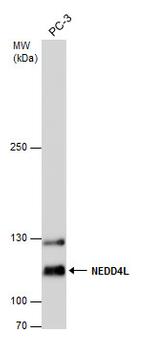 NEDD4L Polyclonal Antibody