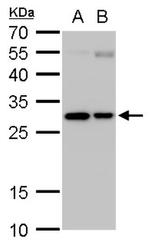 UNC84A Antibody in Western Blot (WB)
