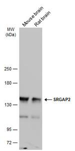 SRGAP2 Antibody in Western Blot (WB)