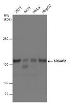 SRGAP2 Antibody in Western Blot (WB)