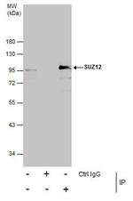 SUZ12 Antibody in Immunoprecipitation (IP)